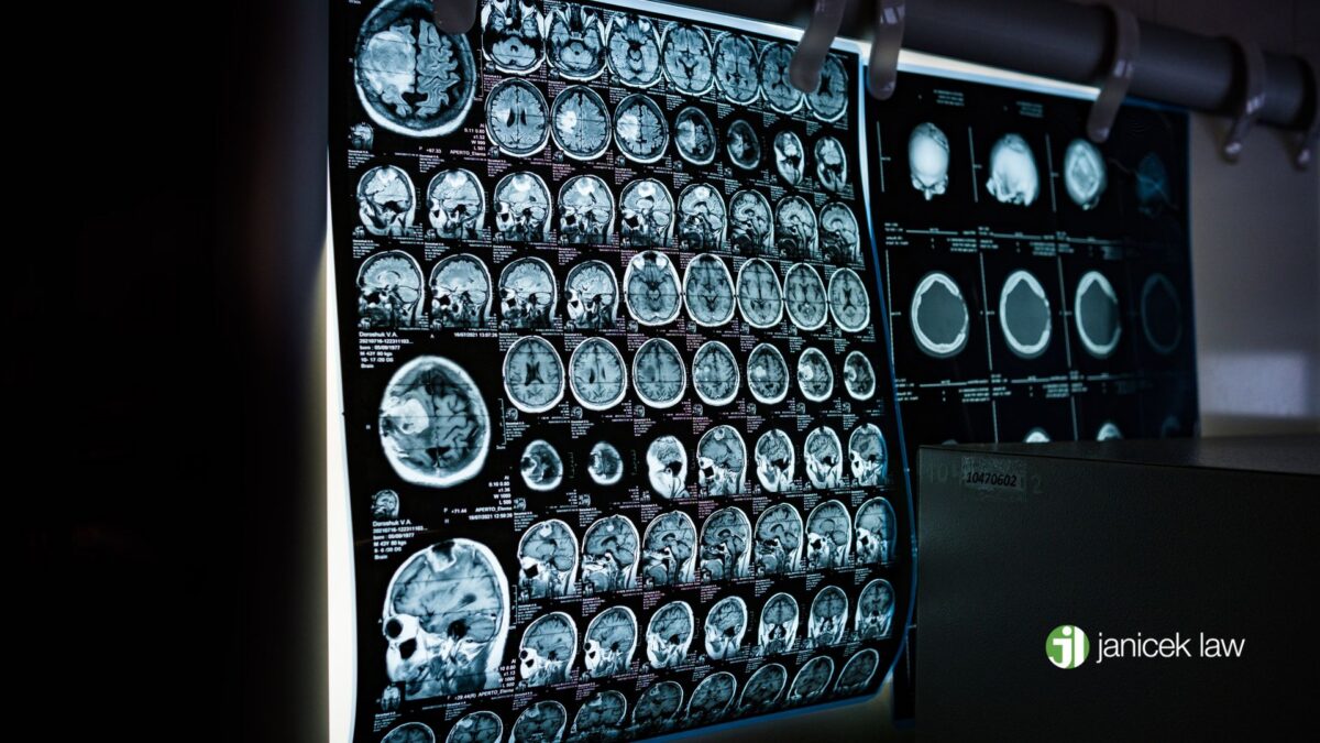 san antonio car accident brain injury lawyer