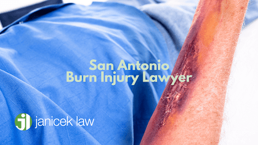 San Antonio Burn Injury Lawyer