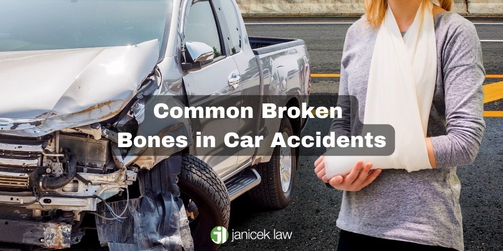 Fracturas de huesos comunes en accidentes automovilísticos