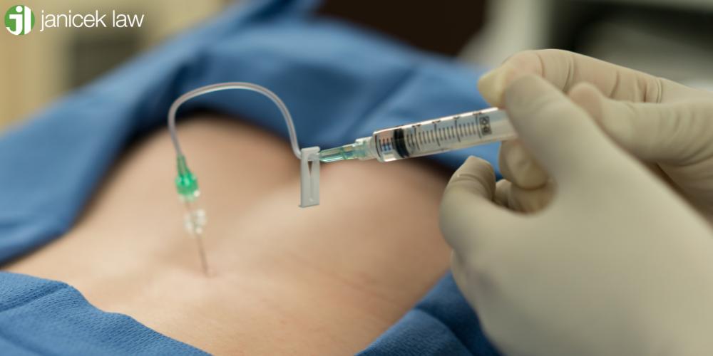 epidural malpractice