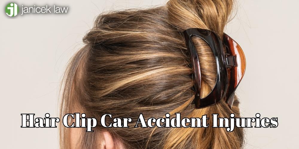 pinza para el cabello lesiones por accidentes automovilísticos